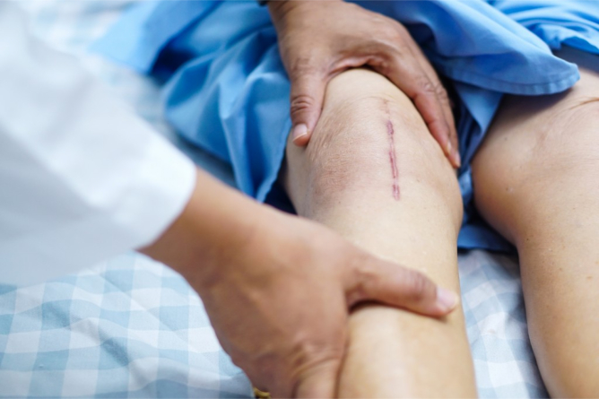 Tips to Prep the Home After a Knee Replacement Surgery